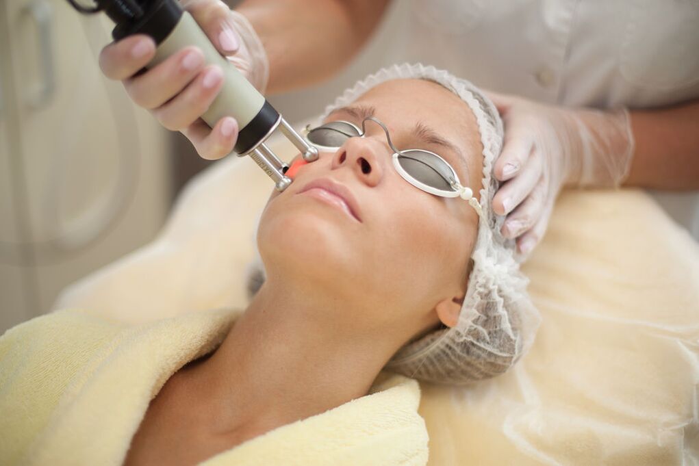 Skin laser rejuvenation