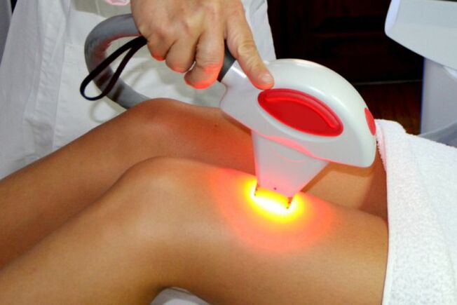 Removal of laser hair